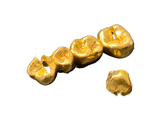 金歯・歯科板金